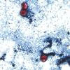 Local medical experts keeping an eye on the ongoing cyclospora outbreak