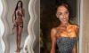 Fans share health fears for Australian influencer as she reveals the 'insane' results of the controversial Bali 'Barbie Waist' surgery