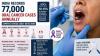 World Head And Neck Cancer Day 2026: Experts Urge Early Detection As India Records 77,000 Oral Cancer Cases Annually, 15 Per Cent Recurrence