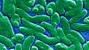 Palm Beach County person dies of 'flesh-eating bacteria.' What is it?