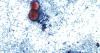 CDC sending ‘disease detectives’ to Ohio to help with cyclosporiasis investigation