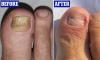 My crusty yellow toenails looked like an animal's claws and disgusted my children. But I cured them for ever with a simple, life-changing treatment. Here are the steps I took: SIMON MILLS