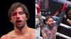 Love Island star Jack Fincham left covered in blood after bareknuckle battering by Aaron Chalmers as doctor stops fight