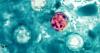 Allegheny County reports 35 cyclosporiasis cases, 2 hospitalizations