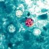 Mexico, RFK Jr., Taylor Farms point fingers in cyclospora outbreak