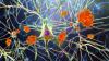 KY scientists learned what causes sleep loss in Alzheimer’s patients — and how to stop it 