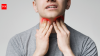 Head and neck cancer is no longer just a smoker's disease: Doctors reveal the changing risks every Indian should know