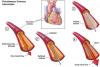 Macao Union Hospital performs 1st emergency heart procedure to save tourist