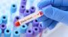 Ebola cases cross 3,200 as Bundibugyo outbreak spreads to Uganda, vaccine trial underway
