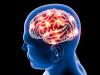 Pay attention: More people living with neurological conditions