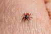 Bitten By An Illinois Tick? Here’s When To Seek Medical Attention