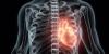 Morgantown hospital first in U.S. to use new AI-assisted technology during heart rhythm procedure