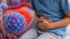 Mumbai sees rise in rotavirus cases: Doctors share 2 precautions to follow