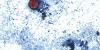 Douglas County Health Department says local Cyclospora cases have increased