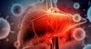 Hepatitis B and C Continue to Affect Thousands in Afghanistan, WHO Warns