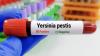 Plague Vaccines Protect Mice Without Immune Defense Scientists Thought Essential