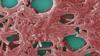 Lawsuits announced against NYC over deadly 2025 Harlem Legionnaires' outbreak