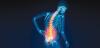 Five Lifestyle Mistakes Weakening Bones