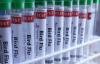 Australia confirms H5 bird flu spreading in native bird population