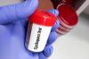 More Than 18,000 Cases of Cyclosporiasis Confirmed or Suspected Across 45 States as FDA Says ‘U.S. Food Supply Is Safe’