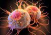 Scientists replay cancer's earliest moments to reveal how tumors begin