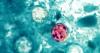 ‘Worst experience I’ve ever had’: Kansas woman suing Taco Bell over cyclosporiasis