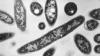 Several cases of Legionnaires’ disease confirmed in Franklin County, health department reports