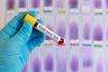 Ebola vaccine race accelerates as Congo outbreak outpaces response