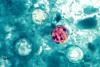 Maryland confirms nearly 150 cases of diarrhea-causing parasite