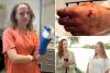 Girl, 13, bitten by barracuda in bloody ‘horror movie’ attack during Turks and Caicos birthday trip