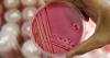 Colorado is seeing a ‘significant increase’ in salmonella cases. Here’s what you should know.