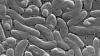 Florida reports first flesh-eating bacteria death of 2026