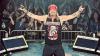 The Update | Surgery Sidelines Bret Michaels, but Canfield Show Is Still Scheduled
