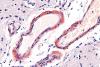 URI receives $1.5 million grant to study disease prevalent in elderly population and those with Alzheimer’s disease