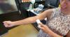 Arizona women facing estrogen patch shortage