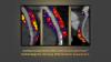 Caristo Diagnostics’ coronary inflammation technology gains FDA authorisation
