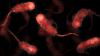 Warning as 7 killer diseases surge in European holiday hotspots – from swimming parasite to ‘explosive’ diarrhoea
