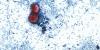 Cyclospora confirmed in more than 220 Iowans