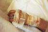 Who Qualifies for Medical Aid in Dying in New York?