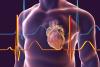 Implementing Simulation-Based Learning to Improve Self-Care for Chronic Heart Disease