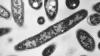 NYC Health Department announces two more deaths in Upper East Side Legionnaires' outbreak