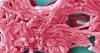 NYC Health Department gives Legionnaires' update after 7th death in Upper East Side cluster