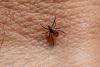 CDC Data Now Show 3,586 Babesiosis Cases in a Single Year as the 2026 Tick Season Peaks