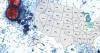 Diarrhea-causing parasite cases climb to 264 in Florida; Lee County reports 25