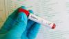 Health officials warn public after rabies cases in SC