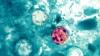 Should you be concerned about Cyclospora in Minnesota?