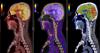 6 ways to improve your memory according to UTD brain research