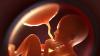 New Evidence That Microplastics Can Cross Placental Barrier And Alter Hormone Production