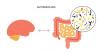 Gut feelings: How stress may reshape the microbiome and influence brain health