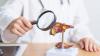 Seeking a Lasting Cure for Hepatitis B